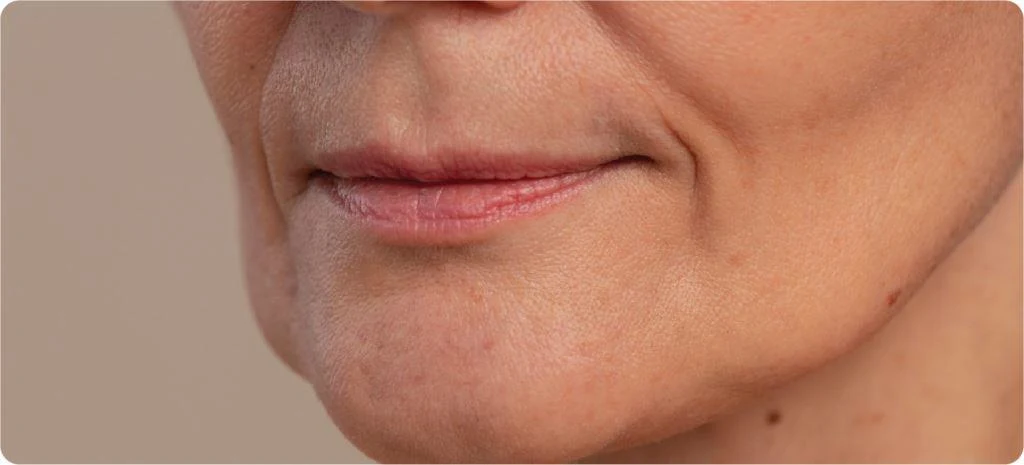 Volume Loss & Facial Contouring