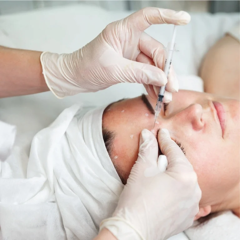 Dermal Fillers