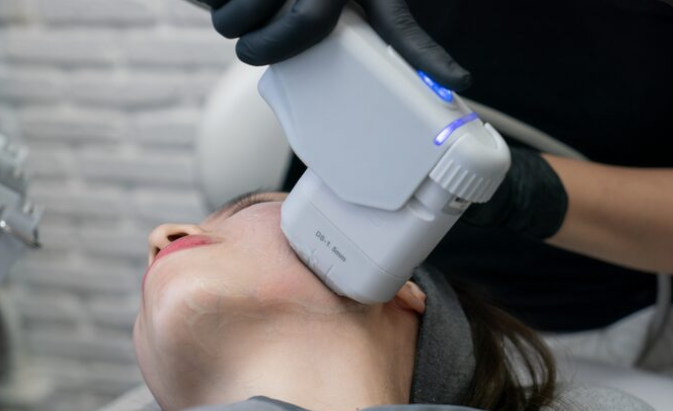 HIFU Treatment